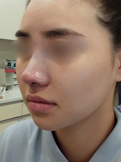 AFTER